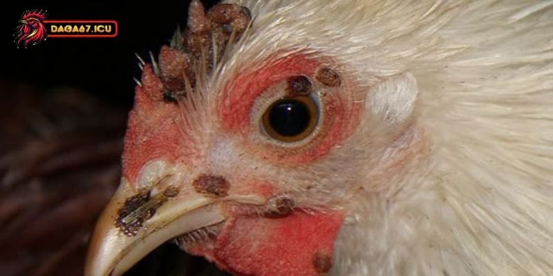 Các loại thuốc ngừa bệnh bị gà sưng mắt hiệu quả